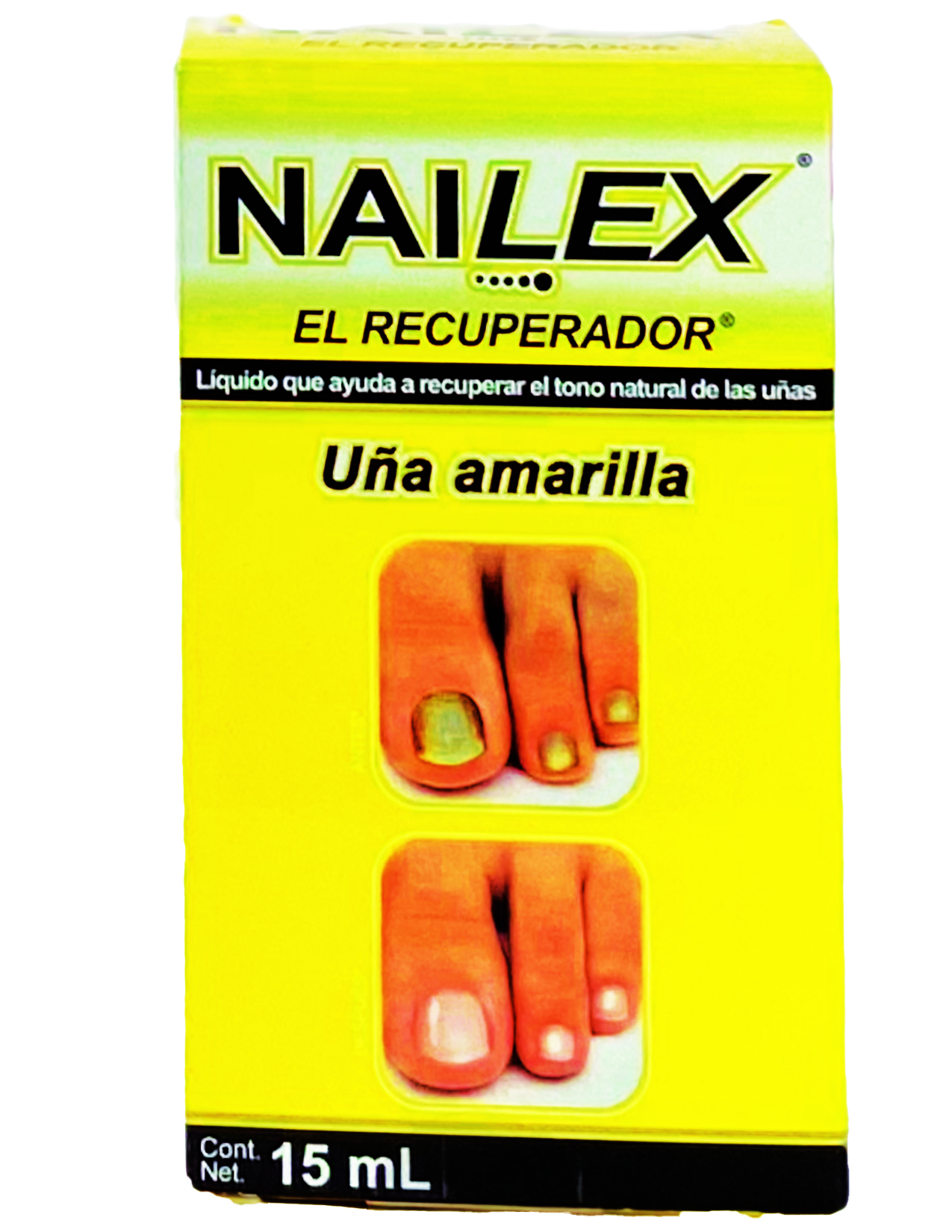 Nailex - El Recuperador Liquid Solution 15ml