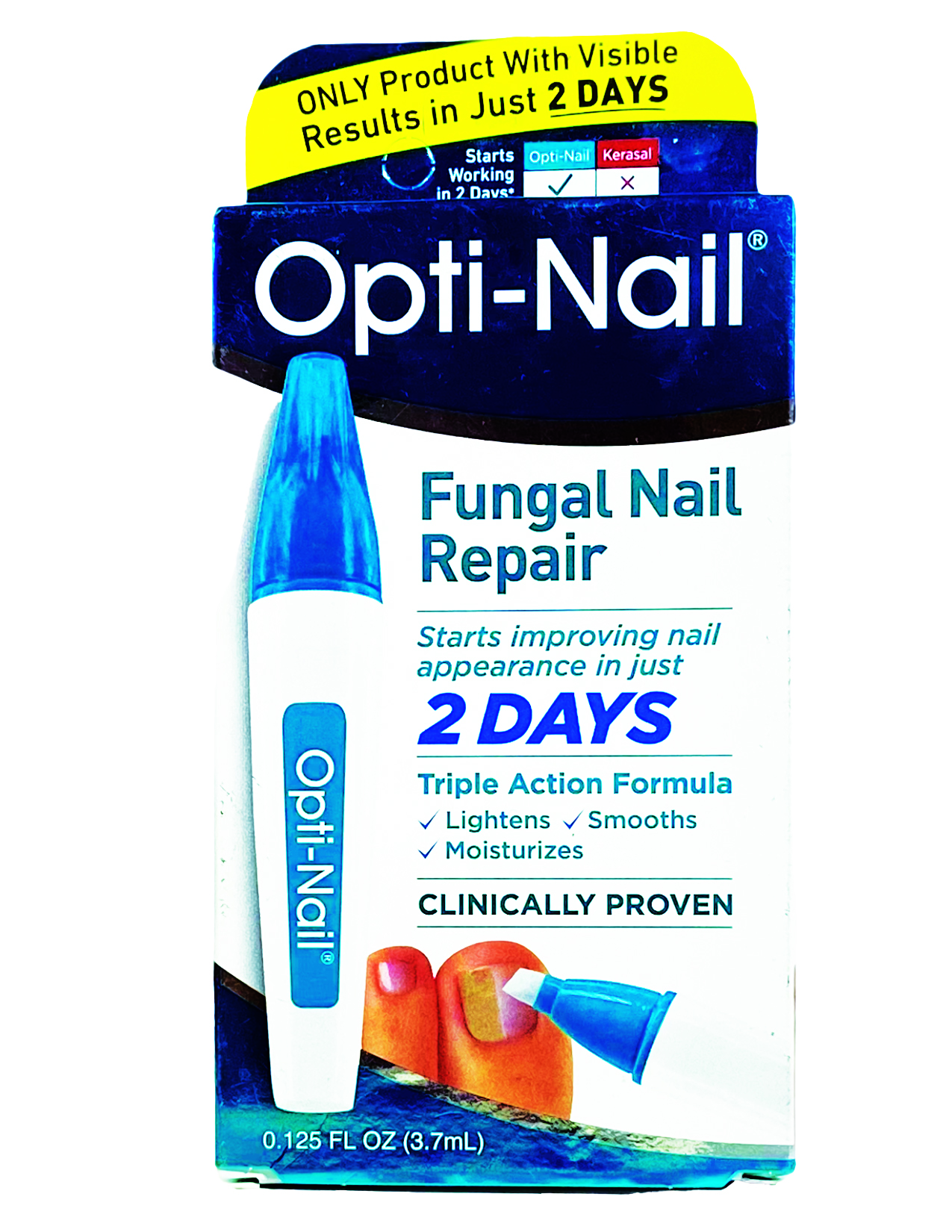 Opti-Nail - Fungal Nail Repair